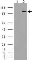 PAB7421 - Alpha-Mannosidase 2 / MAN2A1