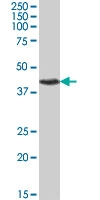 PAB7438 - PITX3 / PTX3