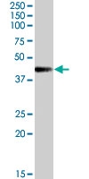 PAB7439 - MC2-R
