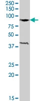 PAB7442 - Exonuclease 1 (EXO1)