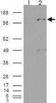 PAB7443 - Pyruvic carboxylase (PC)