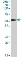PAB7447 - Aromatase