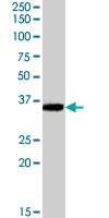 PAB7448 - AKR1B10