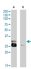 PAB7461 - Myogenic factor 5 (MYF5)