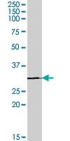 PAB7464 - IGFBP4
