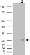 PAB7465 - IGFBP6
