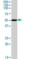 PAB7469 - Neuronal acetylcholine receptor subunit beta-3