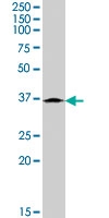 PAB7476 - Cathepsin K