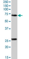 PAB7490 - Alpha-2-antiplasmin / SERPINF2