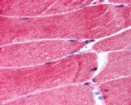 PAB7497 - TRIM63 / MURF1 / RNF28