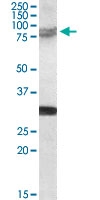 PAB7498 - TRIM2 / RNF86