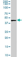 PAB7503 - Asporin