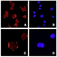 PAB7503 - Asporin