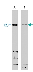 PAB7505 - SECISBP2