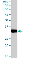 PAB7508 - LDHC