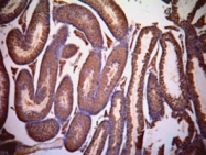PAB7508 - LDHC
