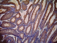 PAB7509 - LDHC