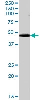 PAB7512 - ACTL7B