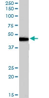 PAB7514 - Beta-3 adrenergic receptor