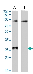PAB7515 - APOBEC2