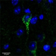 PAB7539 - CRHR1