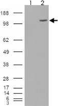 PAB7548 - ESYT1