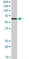 PAB7551 - CD344 / FZD4 / Frizzled-4