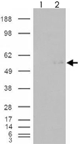 PAB7555 - GCNT3