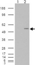 PAB7556 - GCNT3