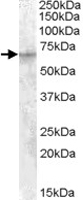 PAB7566 - IGF2BP2