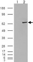 PAB7566 - IGF2BP2