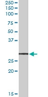 PAB7574 - LYPLAL1