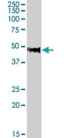 PAB7586 - Neuropeptide FF receptor 1