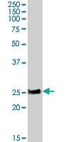 PAB7594 - RAB8A
