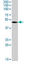 PAB7596 - RASSF6