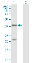 PAB7630-B01P - Genome polyprotein