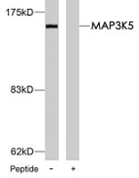 PAB7656 - MEKK5 / ASK1