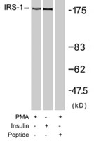 PAB7671 - IRS1
