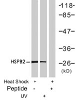 PAB7676 - HSPB1 / HSP27