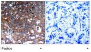 PAB7683 - CD221 / IGF1R