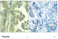 PAB7699 - EIF4G1 / EIF4F
