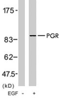 PAB7717 - Progesterone receptor