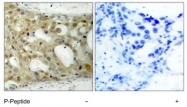PAB7733 - Androgen receptor