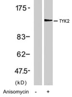 PAB7734 - TYK2
