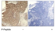 PAB7740 - HDAC2