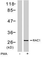 PAB7743 - RAC1