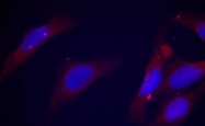 PAB7745 - FAK1 / PTK2