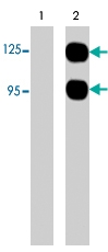 PAB7868 - SEMA3A