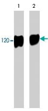 PAB7872 - EGFR / ERBB1
