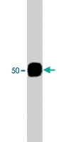 PAB7874 - TUBB3 / TUBB4